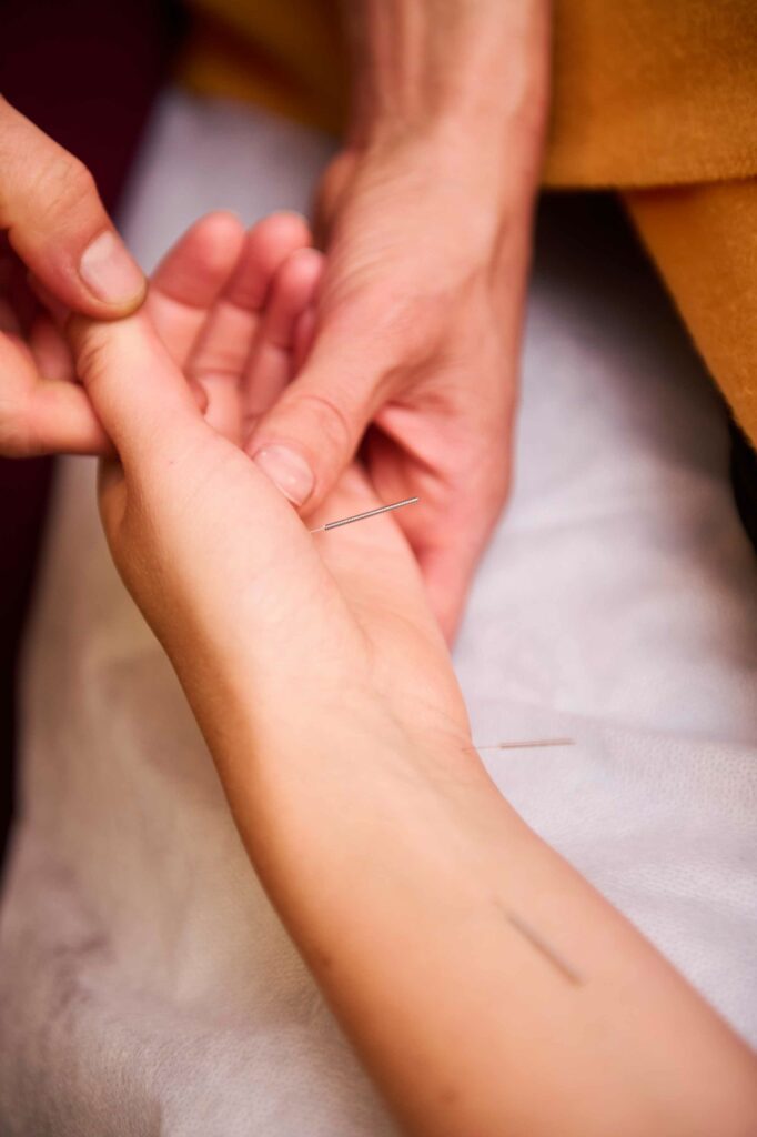 Akupunktur der Hand und des Arms in der Gesundheitspraxis Katrin Lüthi in Bern